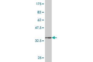 Western Blot detection against Immunogen (33. (LHX5 Antikörper  (AA 114-182))
