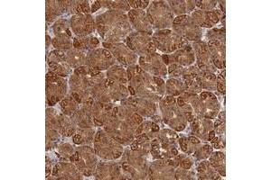 Immunohistochemical staining of human stomach with KATNB1 polyclonal antibody  shows strong cytoplasmic positivity in glandular cells at 1:1000-1:2500 dilution.