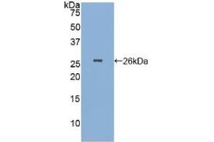 Detection of Recombinant PGA, Human using Polyclonal Antibody to Pepsinogen A (PGA) (Pepsinogen A Antikörper  (AA 63-295))