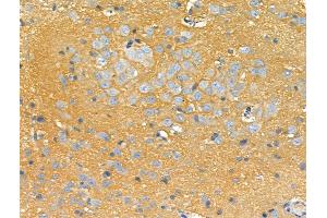 ABIN6259482 and ABIN6275755 at 1/100 staining Rat brain tissue by IHC-P. (STARD10 Antikörper  (Internal Region))