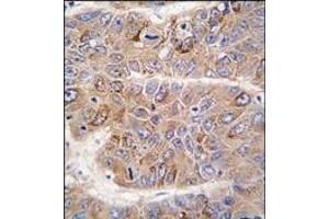 Image no. 2 for anti-Insulin Receptor Substrate 2 (IRS2) (C-Term) antibody (ABIN360098)