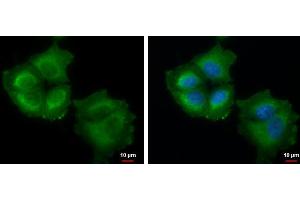 Immunofluorescence (IF) image for anti-Thymidylate Synthetase (TYMS) antibody (ABIN2855587)
