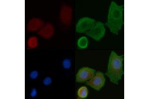 ABIN6258280 and ABIN6275235 staining Hela cells by IF/ICC.