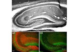 Top: Adult rat hippocampus immunohistochemistry.