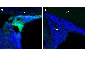 Expression of Adenosine A1 Receptor in rat subventricular zone (SVZ). (ADORA1 Antikörper  (Extracellular))