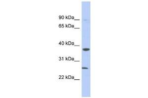 MYD88 antibody used at 1 ug/ml to detect target protein. (MYD88 Antikörper)