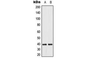 Western blot analysis of DUSP1/4 expression in HeLa (A), Jurkat (B) whole cell lysates. (MKP-1/2 Antikörper  (C-Term))