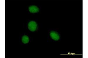 Immunofluorescence of purified MaxPab antibody to ZBTB6 on HeLa cell.