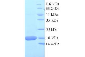 SDS-PAGE (SDS) image for Superoxide Dismutase 1, Soluble (SOD1) (AA 2-154) protein (His tag) (ABIN5713858) (SOD1 Protein (AA 2-154) (His tag))