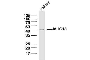 Lane 1: Mouse kidney lysates probed with Anti MUC13 Polyclonal Antibody, Unconjugated  at 1:300 overnight at 4˚C. (MUC13 Antikörper  (AA 175-270))