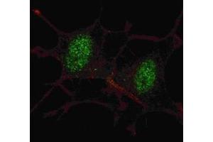 Fluorescent confocal image of SY5Y cells stained with SMAD2 antibody at 1:100.