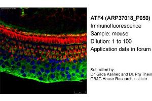 Image no. 1 for anti-Activating Transcription Factor 4 (Tax-Responsive Enhancer Element B67) (ATF4) antibody (ABIN2779919) (ATF4 Antikörper)