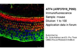 Image no. 1 for anti-Activating Transcription Factor 4 (Tax-Responsive Enhancer Element B67) (ATF4) antibody (ABIN2779919)