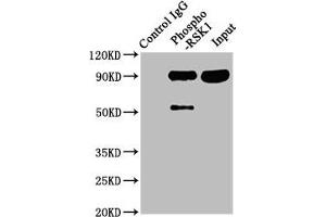 Immunoprecipitating Phospho-RPS6KA1 in Hela whole cell lysate Lane 1: Rabbit control IgG(1 μg)instead of ABIN7127743 in Hela whole cell lysate. (Rekombinanter RPS6KA1 Antikörper  (pSer380))