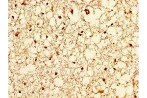 IHC image of ABIN7176635 diluted at 1:200 and staining in paraffin-embedded human brain tissue performed on a Leica BondTM system. (ZIC4 Antikörper  (AA 28-88))