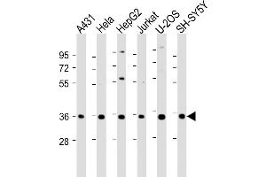 Western Blot at 1:2000 dilution Lane 1: A431 whole cell lysate Lane 2: Hela whole cell lysate Lane 3: HepG2 whole cell lysate Lane 4: Jurkat whole cell lysate Lane 5: U-2OS whole cell lysate Lane 6: SH-SY5Y whole cell lysate Lysates/proteins at 20 ug per lane. (NT5C3 Antikörper  (AA 282-313))
