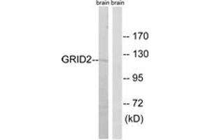 Western Blotting (WB) image for anti-Glutamate Receptor, Ionotropic, delta 2 (GRID2) (AA 831-880) antibody (ABIN2889966) (GRID2 Antikörper  (AA 831-880))