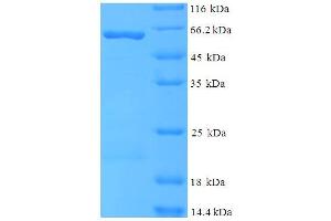 SDS-PAGE (SDS) image for Histone Aminotransferase 1 (HAT1) (AA 1-372), (Isoform 2) protein (His-SUMO Tag) (ABIN5711257) (HAT1 Protein (AA 1-372, Isoform 2) (His-SUMO Tag))