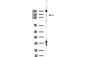 Western blot analysis of lysates from HepG2 cells(starvation,24h treatment), using DCTN1 Antibody at 1/1000 dilution.