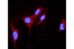 IF analysis of DDAH1 using anti-DDAH1 antibody (ABIN4886560).