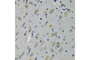 Immunohistochemistry of paraffin-embedded mouse brain using RPS12 antibody (ABIN5973491) at dilution of 1/100 (40x lens). (RPS12 Antikörper)