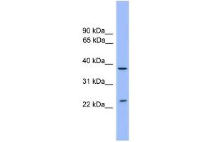WB Suggested Anti-STX4 Antibody Titration: 0. (Syntaxin 4 Antikörper  (Middle Region))