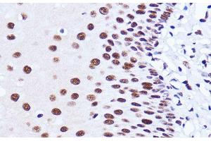Immunohistochemistry of paraffin-embedded Human esophageal using MATR3 Polyclonal Antibody at dilution of 1:100 (40x lens). (MATR3 Antikörper)