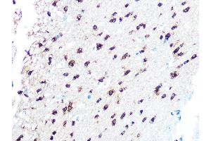 Immunohistochemistry of paraffin-embedded mouse brain using TPPP/p25 Rabbit mAb (ABIN7271031) at dilution of 1:100 (40x lens). (Tppp Antikörper)