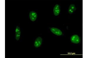 Immunofluorescence of monoclonal antibody to EXOSC5 on HeLa cell. (EXOSC5 Antikörper  (AA 1-235))