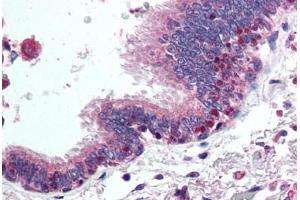 Human Lung, Respiratory Epithelium (formalin-fixed, paraffin-embedded) stained with HDAC4 antibody ABIN294416 at 5 ug/ml followed by biotinylated goat anti-rabbit IgG secondary antibody ABIN481713, alkaline phosphatase-streptavidin and chromogen. (HDAC4 Antikörper  (AA 194-209))