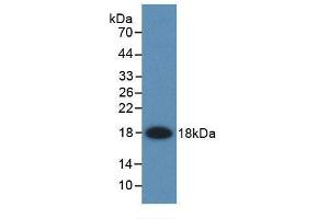 Detection of Recombinant FABP2, Rat using Monoclonal Antibody to Fatty Acid Binding Protein 2, Intestinal (FABP2) (FABP2 Antikörper  (AA 2-132))