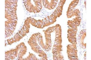 IHC-P Image CES2 antibody detects CES2 protein at cytosol on human colon by immunohistochemical analysis.