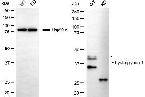 Western blotting analysis using dystroglycan 1 antibody (ABIN7798412). (Rekombinanter Dystroglycan Antikörper)