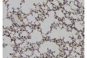 ABIN6267181 at 1/100 staining Mouse lung tissue by IHC-P. (SKP2 Antikörper  (pSer64))