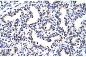 Rabbit Anti-WNT2B Antibody  Paraffin Embedded Tissue: Human Lung Cellular Data: Alveolar cells Antibody Concentration: 4. (WNT2B Antikörper  (Middle Region))