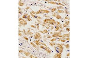 Antibody staining EGF in Human heart tissue sections by Immunohistochemistry (IHC-P - paraformaldehyde-fixed, paraffin-embedded sections). (EGF Antikörper  (AA 690-720))