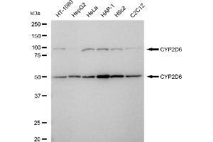 Western blotting analysis using CYP2D6 antibody (ABIN7798255).