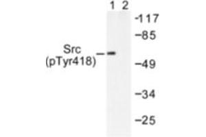 Image no. 1 for anti-Nuclear Receptor Coactivator 1 (NCOA1) (pTyr418) antibody (ABIN318122)