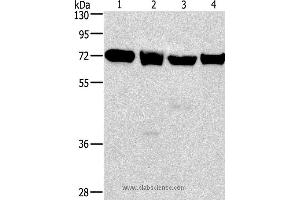 Western blot analysis of 231, 293T, Raji and hela cell, using IL2RB Polyclonal Antibody at dilution of 1:325 (IL2 Receptor beta Antikörper)