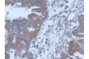 Immunohistochemistry (IHC) image for anti-Protein O-Fucosyltransferase 1 (POFUT1) (AA 238-388) antibody (ABIN7444553)