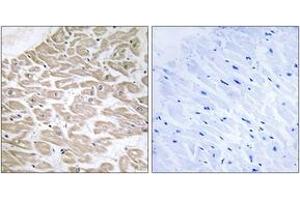 Immunohistochemistry (IHC) image for anti-Ras-Related Associated with Diabetes (RRAD) (AA 41-90) antibody (ABIN2890366) (RRAD Antikörper  (AA 41-90))