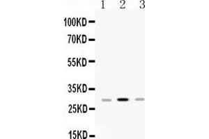 Western blot analysis of HLA-DPB1 expression in rat spleen extract ( Lane 1), mouse spleen extract ( Lane 2) and JURKAT whole cell lysates ( Lane 3). (HLA-DPB1 Antikörper  (AA 30-258))