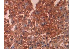 Immunohistochemistry (IHC) image for anti-Carbonic Anhydrase 12 (CA12) (AA 154-307) antibody (ABIN7437902)