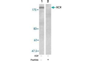 Western blot analysis of extracts from A-431 cells, untreated or EGF-treated (200 ng/ml, 30 min), using BCR polyclonal antibody  . (BCR Antikörper)