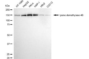 anti-Lysine (K)-Specific Demethylase 4B (KDM4B) antibody