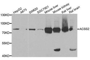 Western blot analysis of extracts of various cell lines, using ACSS2 antibody. (ACSS2 Antikörper)