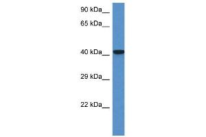 WB Suggested Anti-Zfp759 Antibody   Titration: 1. (Zfp759 Antikörper  (N-Term))