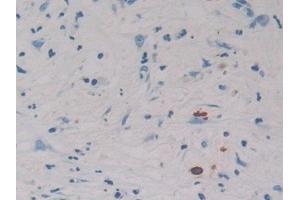 Immunohistochemistry (IHC) image for anti-Regenerating Islet Derived Protein 3 gamma (REG3g) (AA 39-175) antibody (ABIN7435838)