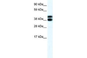 Human Lung; WB Suggested Anti-RFP2 Antibody Titration: 0. (TRIM13 Antikörper  (Middle Region))