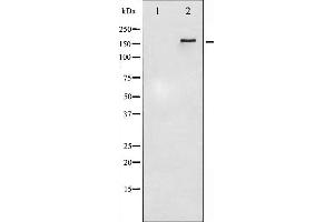 Western blot analysis of HER4 phosphorylation expression in EGF treated HuvEc whole cell lysates,The lane on the left is treated with the antigen-specific peptide. (ERBB4 Antikörper  (pTyr1284))